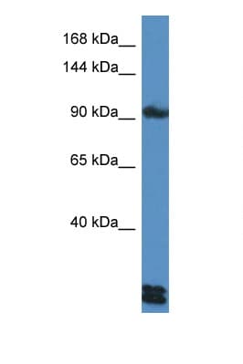DSG3 / Desmoglein 3 Antibody (aa854-903)