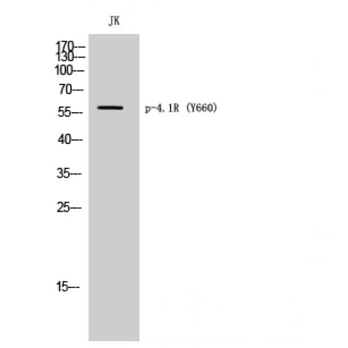 Band 4.1 / EPB41 Antibody (600-680 aa)