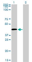 C5AR1 / CD88 / C5a Receptor Antibody (clone 4E2)