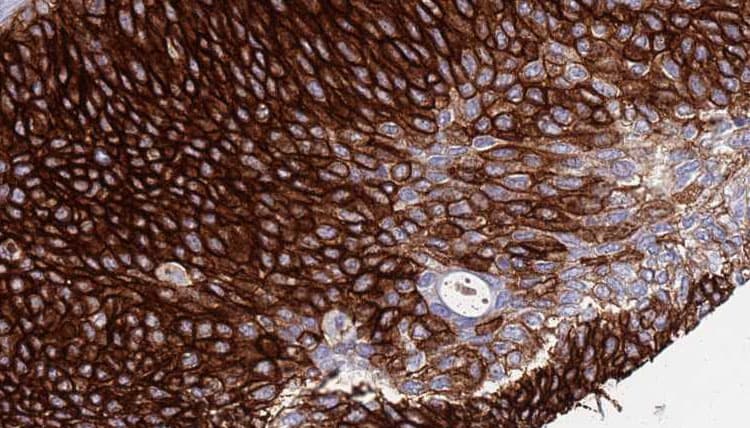 NCSTN / Nicastrin Antibody