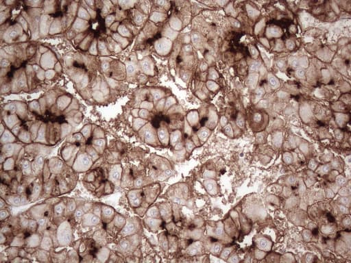 ANPEP / CD13 Antibody (aa668-967, clone OTI2E4)