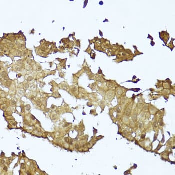 Polyclonal Rabbit anti-Human CTNNB1 / Beta Catenin Antibody (IHC, WB)