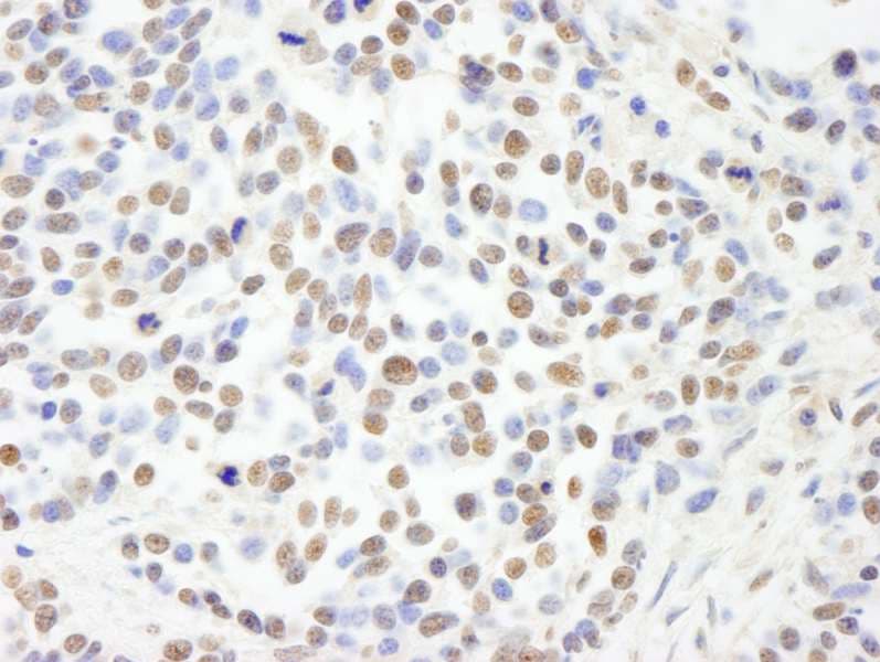 RBBP4 / RBAP48 Antibody (aa1-50)