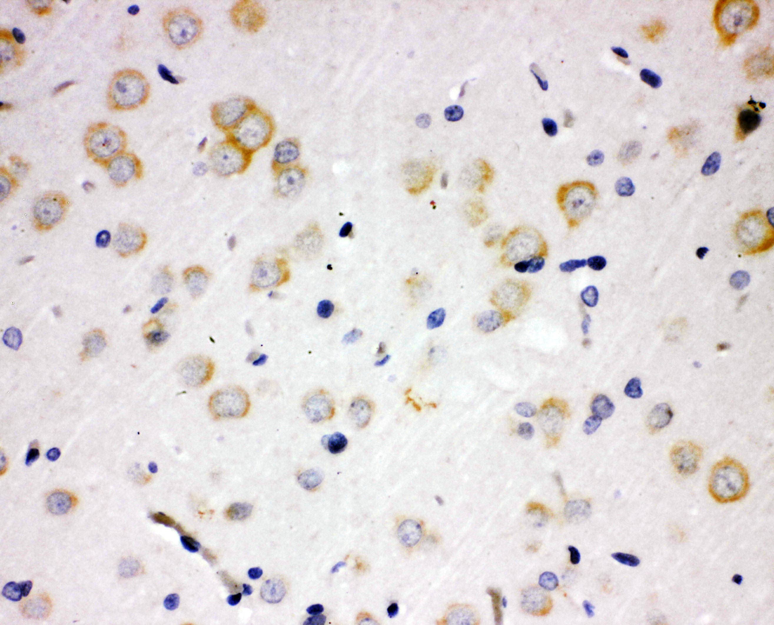 PAK6 Antibody (aa16-32)