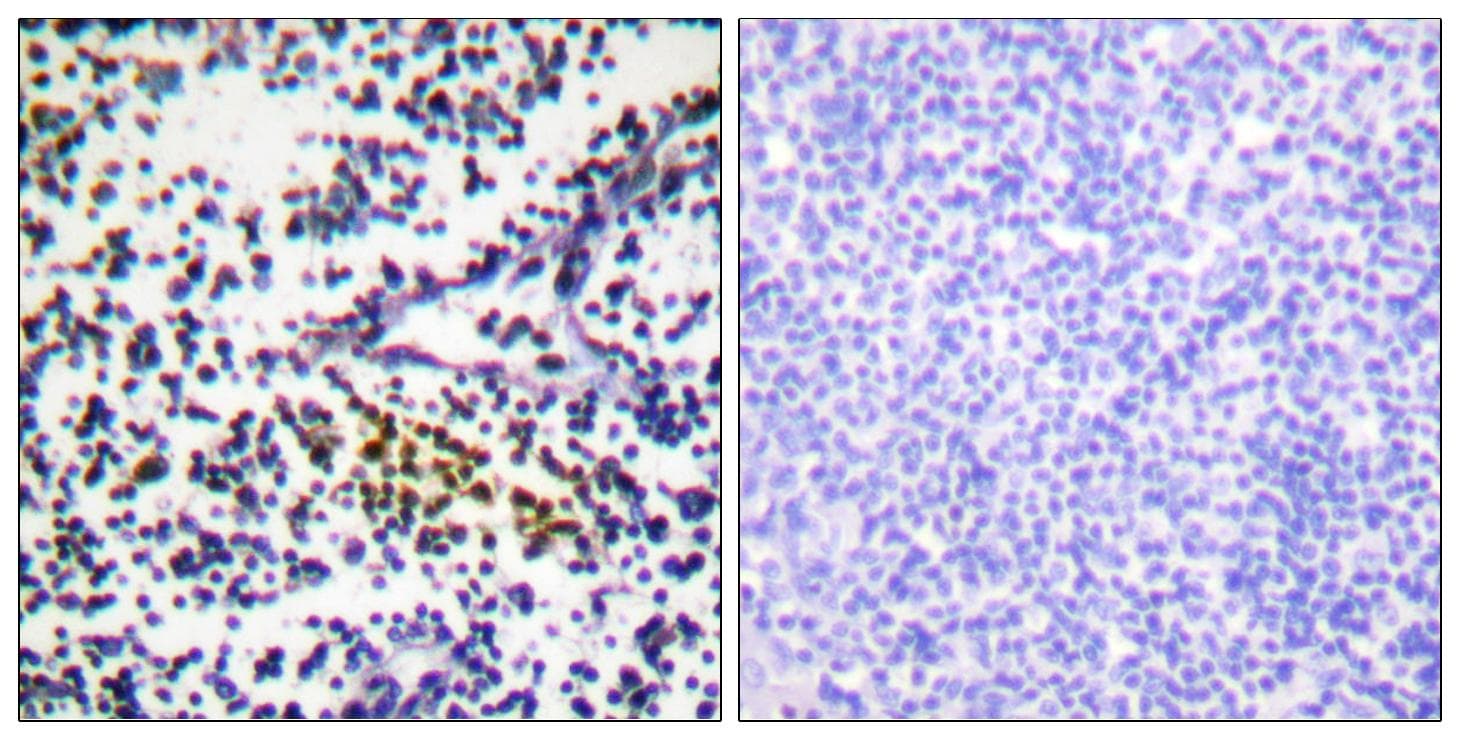 Polyclonal Rabbit anti-Human NUB1 Antibody (IHC, WB)