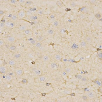 HSD17B2 Antibody