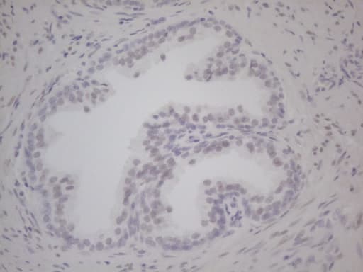 Monoclonal Mouse anti-Human AR / Androgen Receptor Antibody (clone OTI2E6, aa420-659, IHC, WB)