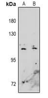 Polyclonal Rabbit anti-Human EPHA10 / EPH Receptor A10 Antibody (WB)