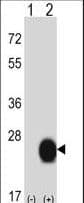 Polyclonal Rabbit anti-Human CSRP2 Antibody (aa68-96, IHC, WB)