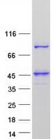 Human UBXN11 / SOC Protein (Recombinant Myc-DDK (Flag))