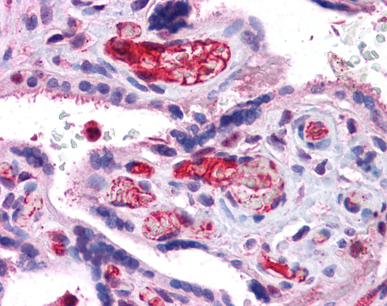 ARG1 / Arginase 1 Antibody (N-Terminus)