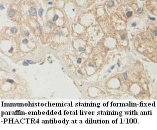 Polyclonal Rabbit anti-Human PHACTR4 Antibody (aa139-378, IHC, WB)