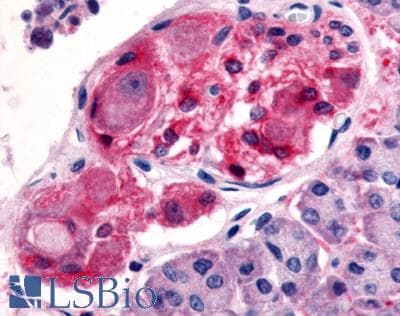 IHC-plus™ HTR2C / 5-HT2C Receptor Antibody (Cytoplasmic Domain)