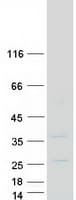 Human SNAI3 Protein (Recombinant Myc-DDK (Flag))