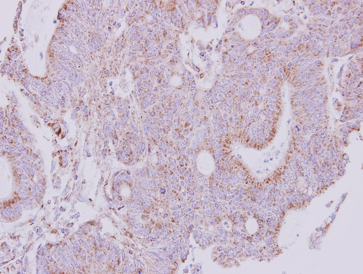 NDUFS1 Antibody (aa432-664)