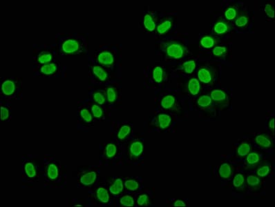 HIST1H4I Antibody