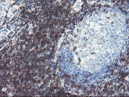 Monoclonal Mouse anti-Human DPH2 Antibody (clone OTI4D9, IHC, WB)