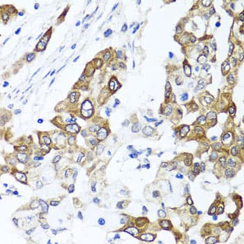 Polyclonal Rabbit anti-Human PPOX Antibody (IHC, IF, WB)