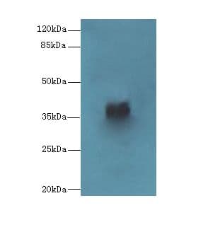 Polyclonal Rabbit anti-Human CAB39L Antibody (WB)