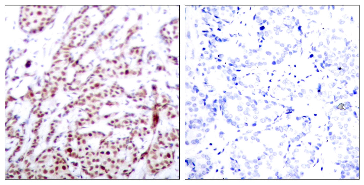 ATF2 Antibody (phospho-Thr73)