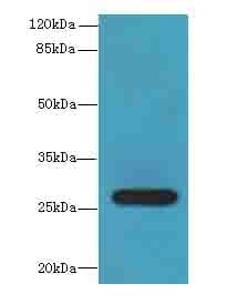 Polyclonal Rabbit anti-Human TEX35 / C1orf49 Antibody (IHC, WB)