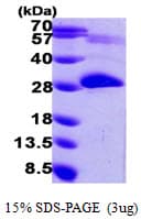 Human PNPO Protein (Recombinant His)