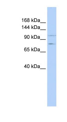 PTPRH / SAP-1 Antibody (aa576-625)