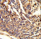 ARPC1B / p41-ARC / ARP2 Antibody (aa159-188)