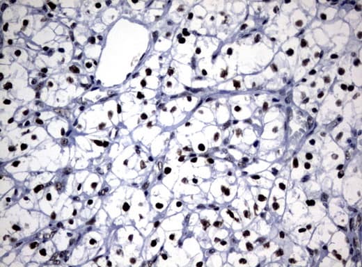NBN / Nibrin Antibody (aa461-754, clone UMAB99)