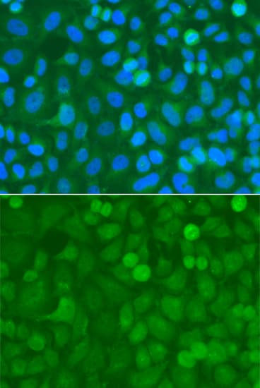 NCK1 / NCK Antibody