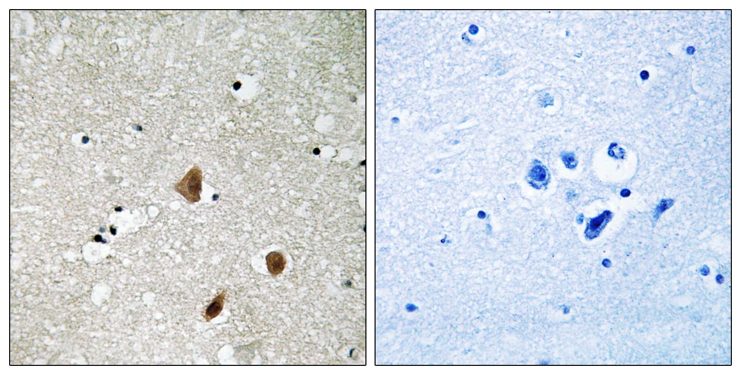 Polyclonal Rabbit anti-Human PAK3 Antibody (phospho-Ser154, IHC, WB)