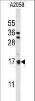 PTMS / Parathymosin Antibody (aa57-85)