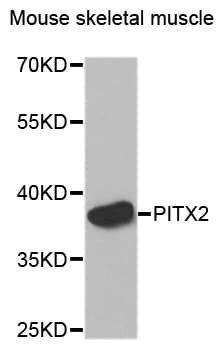 PITX2 / RGS Antibody