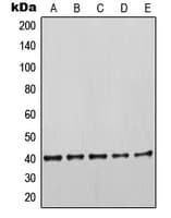 IHC-plus™ KRT19 / CK19 / Cytokeratin 19 Antibody (Internal)