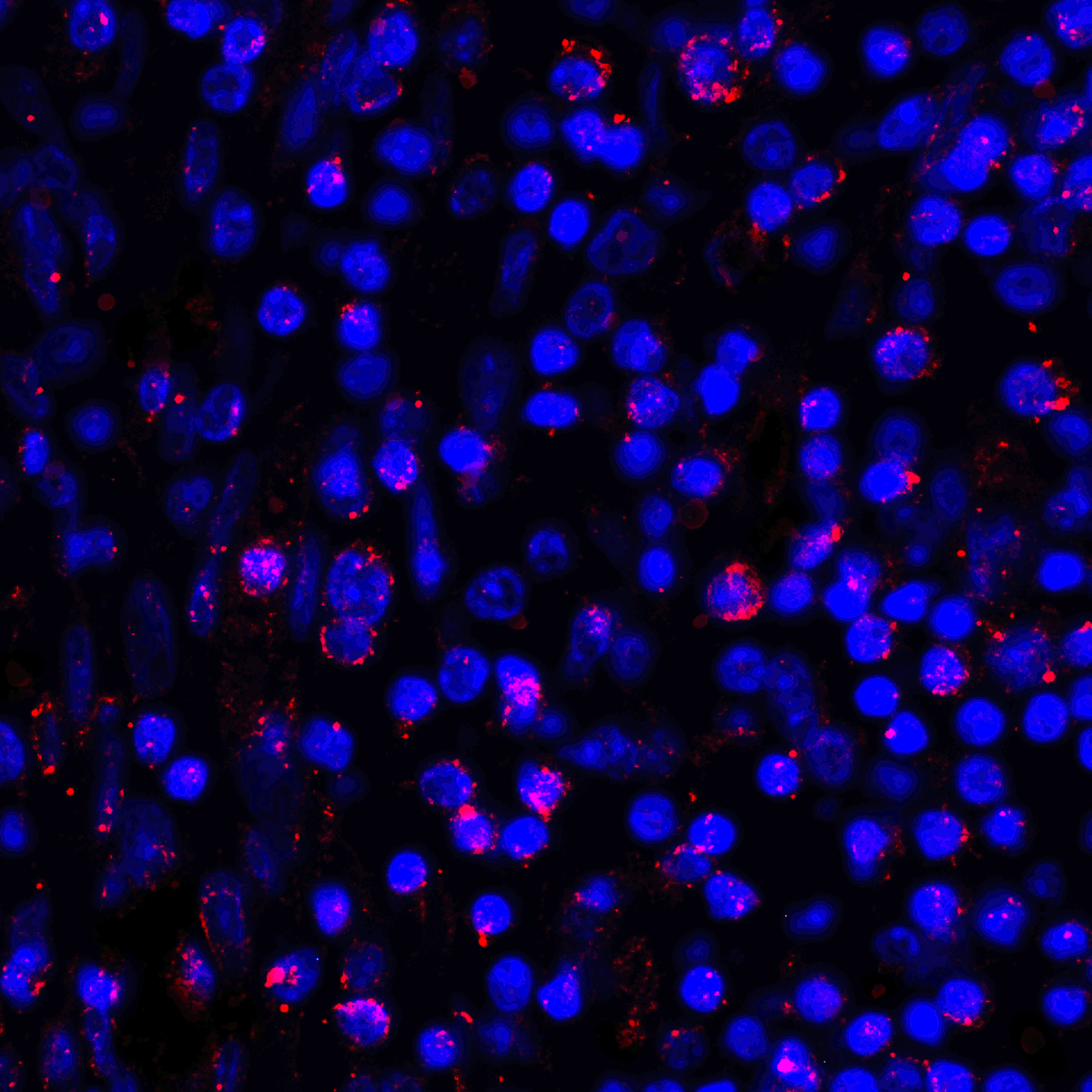 CD274 / B7-H1 / PD-L1 Antibody (clone 1D7)