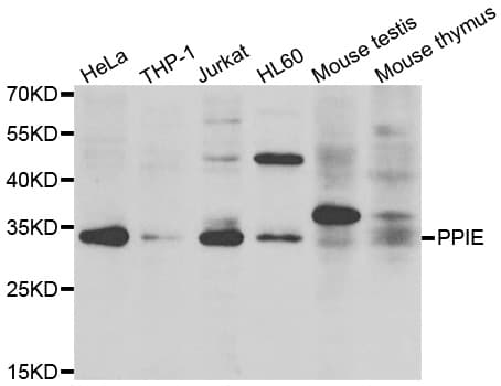 Polyclonal Rabbit anti-Human PPIE / Cyclophilin E Antibody (IHC, WB)