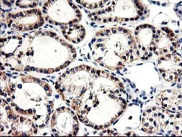 CNDP2 Antibody (clone OTI6D3)