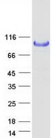 Human HK1 / Hexokinase 1 Protein (Recombinant Myc-DDK (Flag))