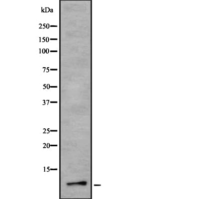 S100A6 / Calcyclin Antibody