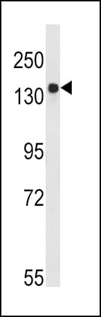 IHC-plus™ Tuberin / TSC2 Antibody (Ser1798)