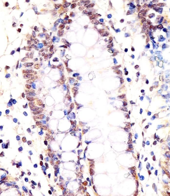 LSM2 / SnRNP Antibody (aa55-89)