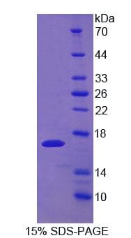 Mouse UPK1A / Uroplakin 1A Protein (Recombinant His, N-Terminal)