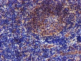 EPN2 Antibody (clone OTI1C2)