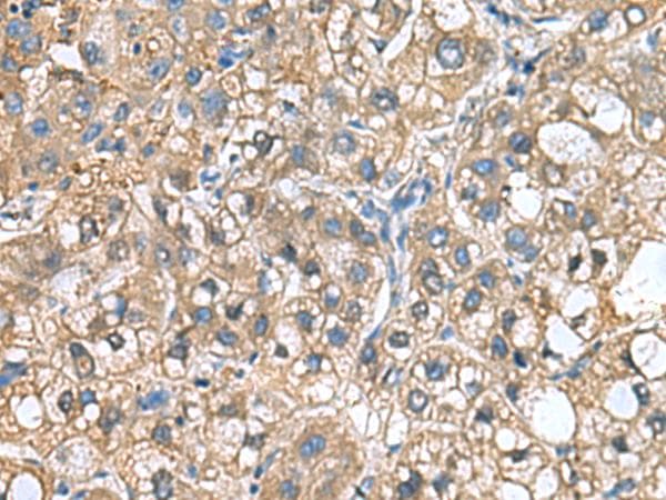 IGLL1 / CD179b Antibody