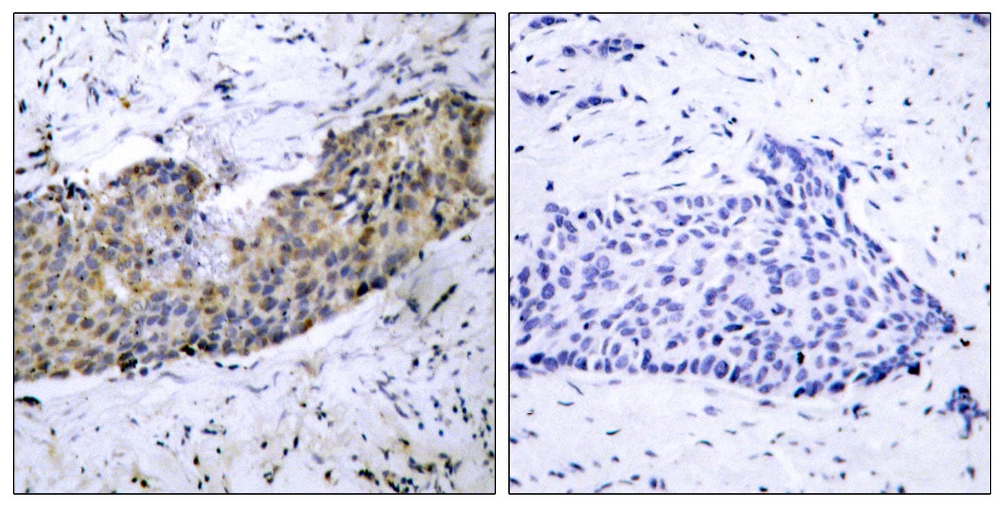Polyclonal Rabbit anti-Human KDR / VEGFR2 / FLK1 Antibody (aa1180-1229, IHC, WB)