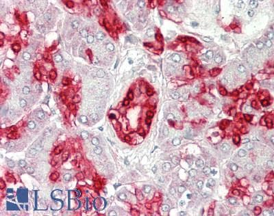 IHC-plus™ CA2 / Carbonic Anhydrase II Antibody