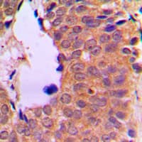 NFKB2 Antibody (C-Terminus)