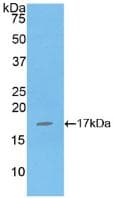 Human IL16 Protein (Recombinant His, N-Terminal)