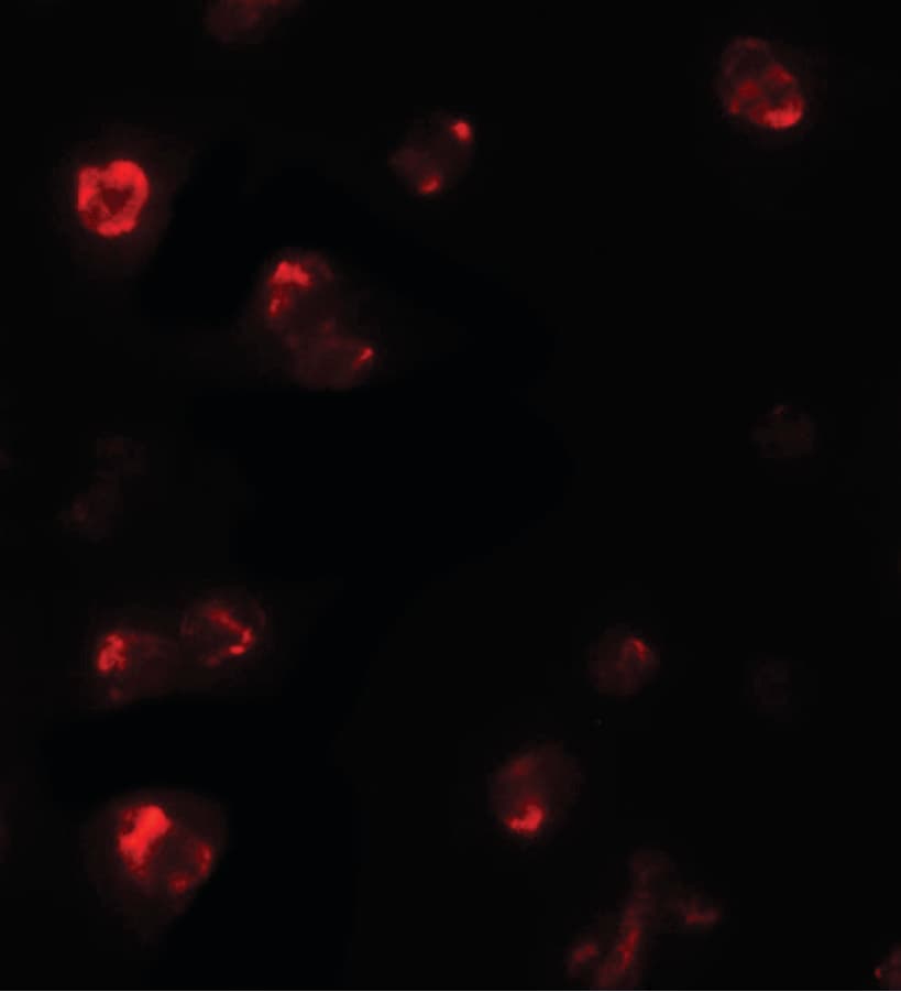 IHC-plus™ TBX21 / T-bet Antibody