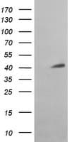 ACAA2 Antibody (clone OTI2G6)